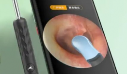 掏耳屎视频,趣味视频带你了解耳垢的奥秘